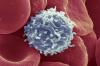 वैज्ञानिकों ने एक रास्ता मिल गया है, कैंसर से लड़ने के शुरू करने के लिए टी कोशिकाओं के कारण