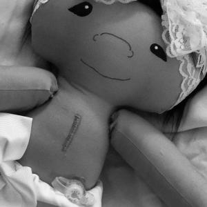 गुड़िया का इलाज: महिला विकलांग समर्थन बच्चों के लिए गुड़िया प्रस्तुत
