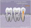 कैसे लूमेंट में दंत नहरों को खोजने और उनका इलाज करें