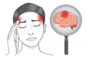 सिर दर्द के 7 प्रकार: क्या स्थानीयकरण का कहना है कि विशेष रूप से इलाज