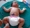 6 से 8 किलो: दुनिया के सबसे बड़े नवजात शिशु