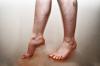 पैरों में रक्त के प्रवाह के उल्लंघन: कारणों, लक्षण