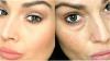 मदद करने के लिए 5 प्राचीन व्यंजनों देखो ताजा और आँखें और युवा आसपास लोचदार त्वचा बनाने