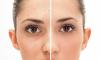 4 शक्तिशाली उपकरण चेहरे पर pores से छुटकारा पाने के